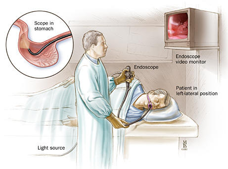 Endoscopy Procedure - by Freedom From Obesity Shreveport